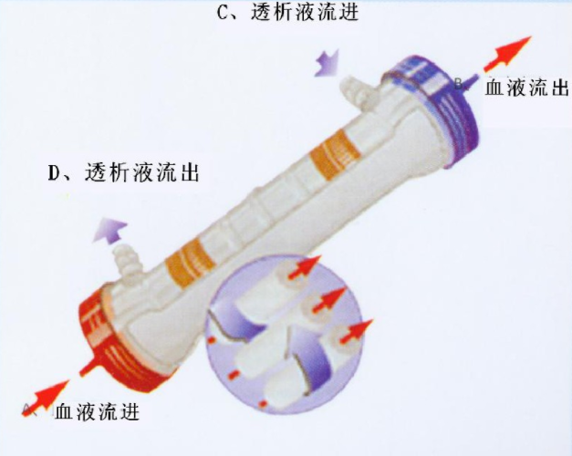 血液透析原理--中新華美改性塑料